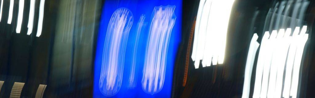 切尔西新星埃斯特旺闪耀，未来足坛巨星崛起！